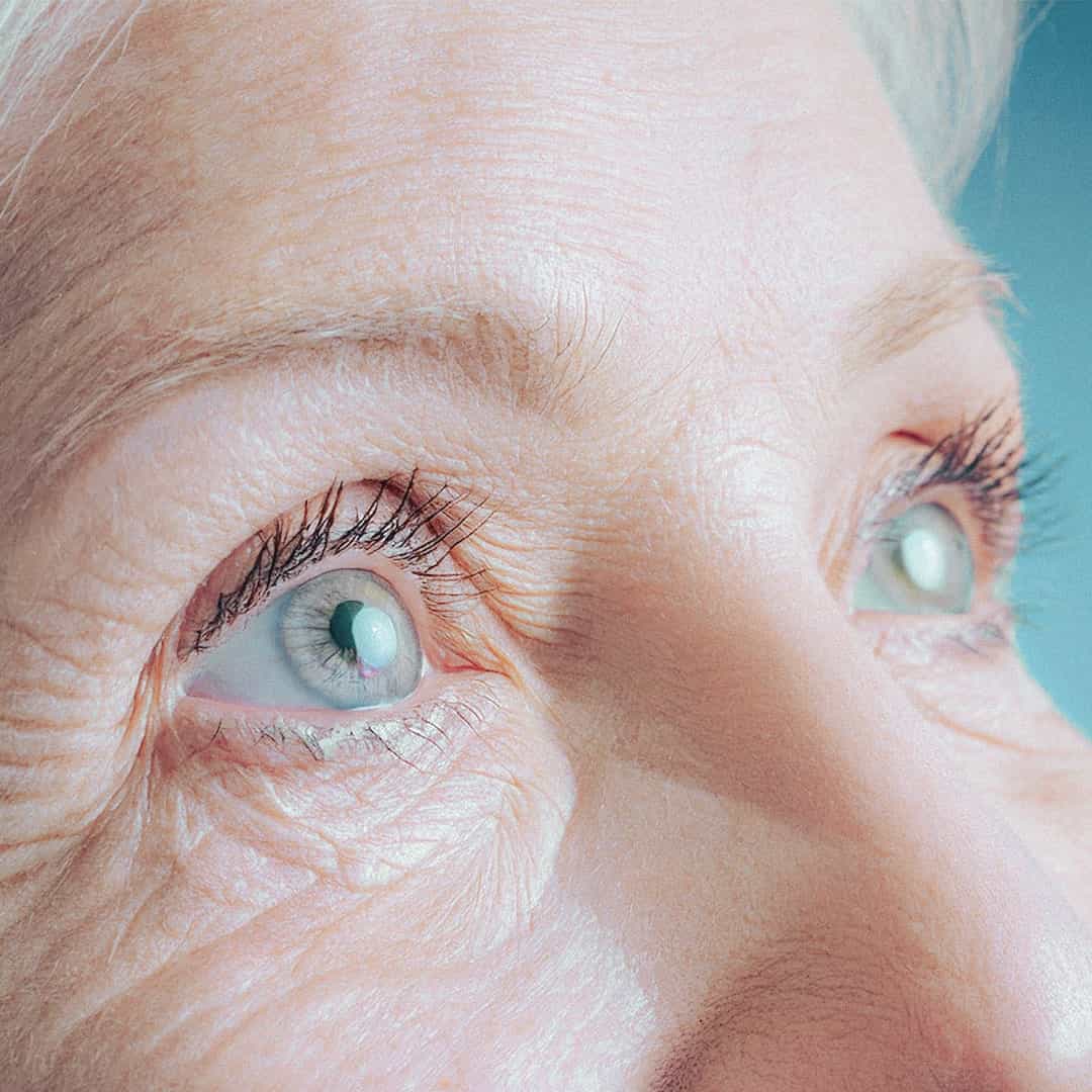 tumbnail-IGCPharma-names-IGC-AD1-Phase-2-Clinical-Trial-for-Alzheimers-Agitation-CALMA-min